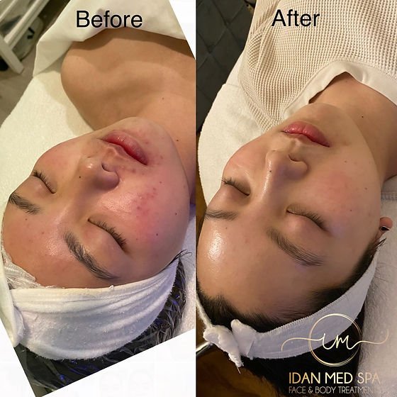 1cef1b_3f6e15da746c4e1788c579ce0bbe13a9_mv2