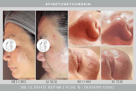 AF1QipMUe1FlVX8KDALed8QKZOZxIVjVm_smTqvxQkU_s435-k-no