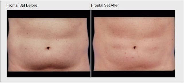 AF1QipORZJGTkW6tvfiC70VtdY6-f3d2SIPkWwqs3S-b_s642-k-no