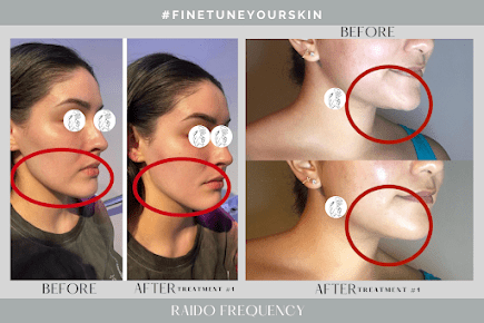 AF1QipOyctRXoSWbnvqsxjd4U5kphGxIBRltMchgYng_s435-k-no