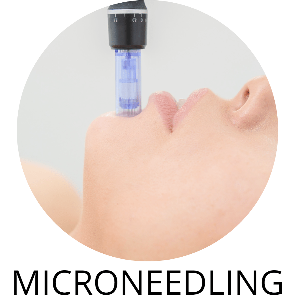 Microneedling-5