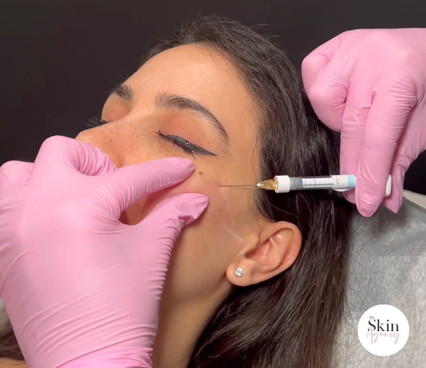 Toluca Lake med spa model with black hair