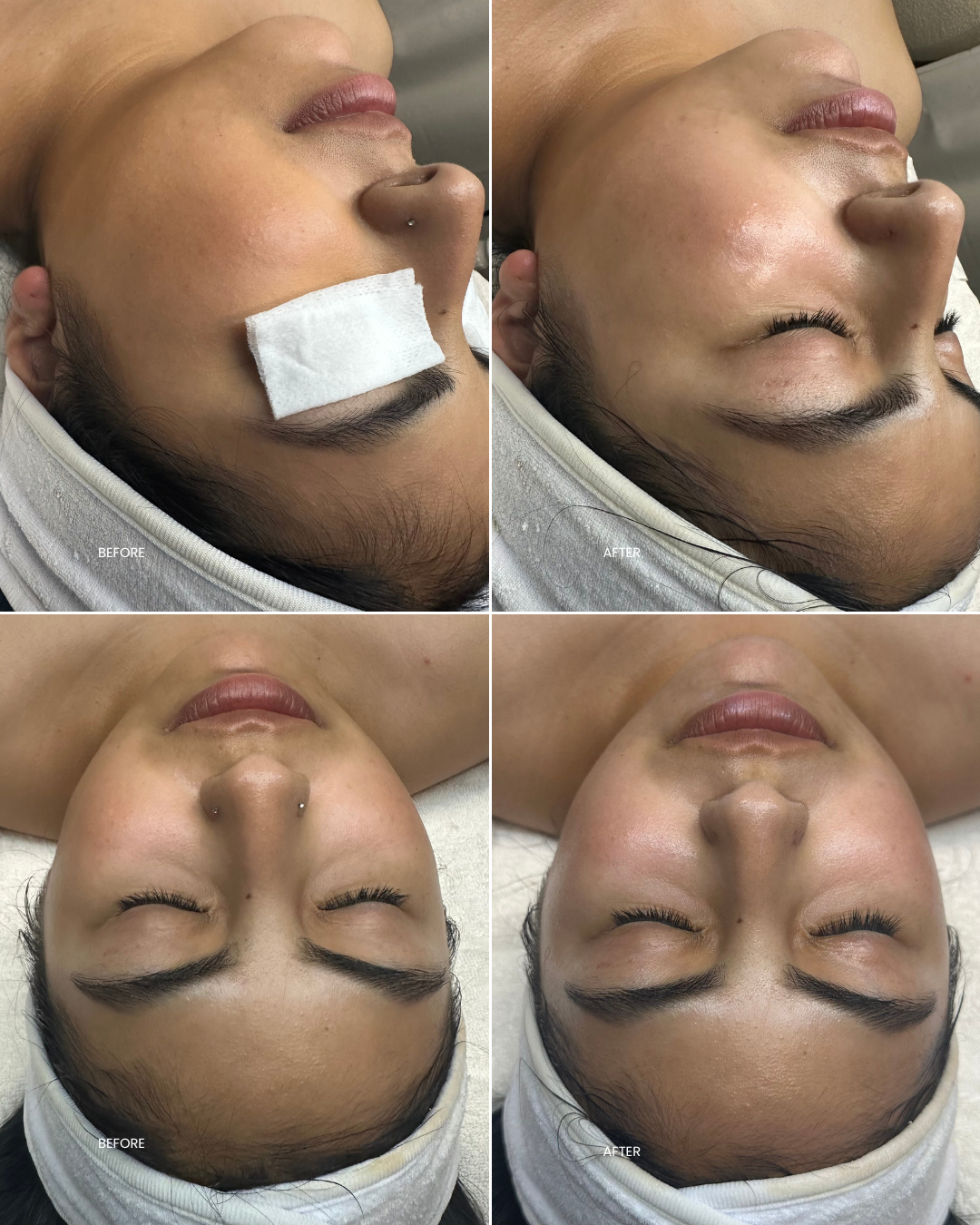 DS Before After 020426