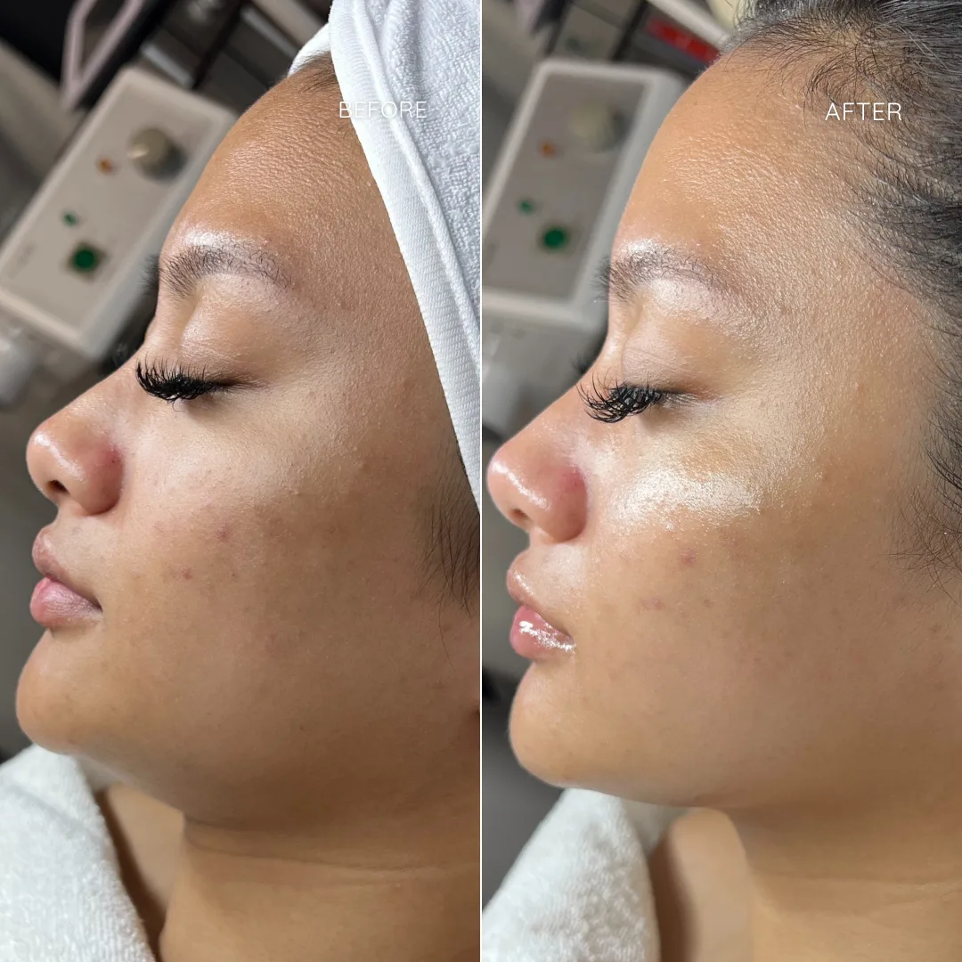 SFE B&A 030124