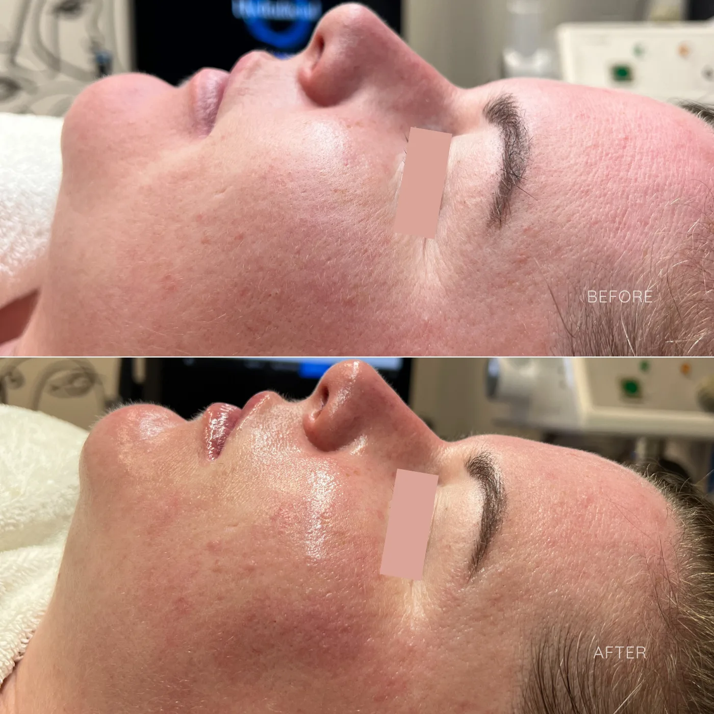SFE B&A 031224