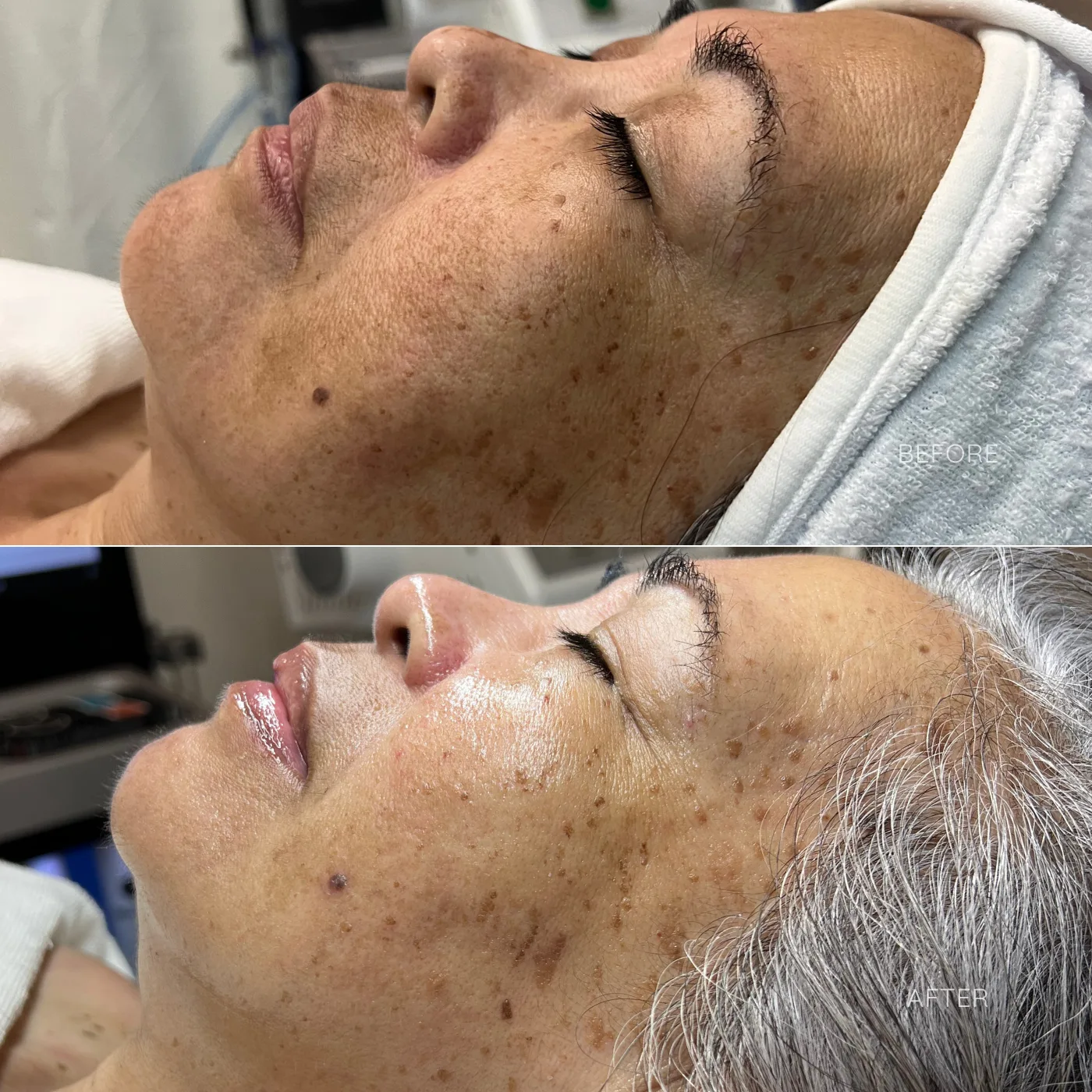 SFE B&A 040824