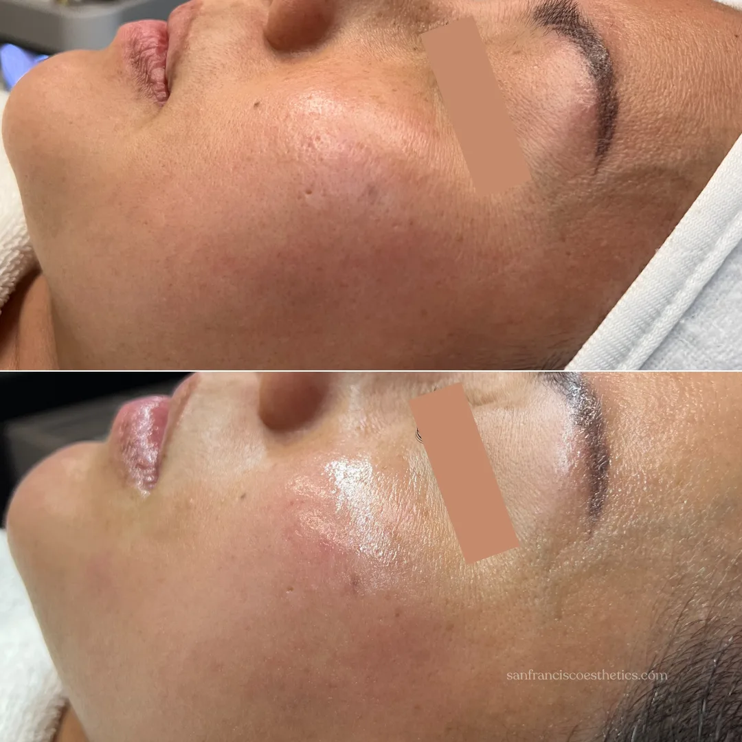 SFE B&A 081325