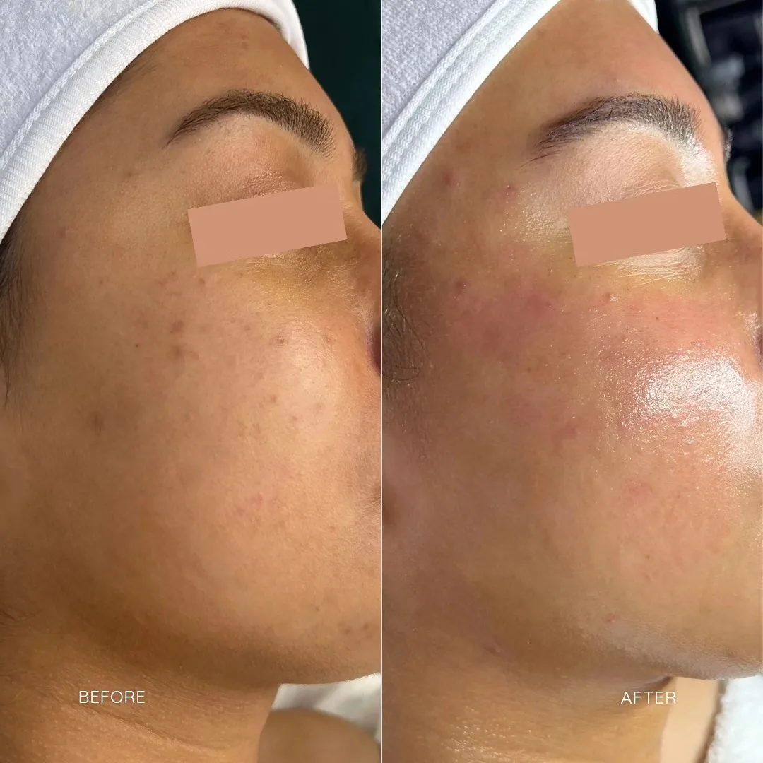 sfe b&a