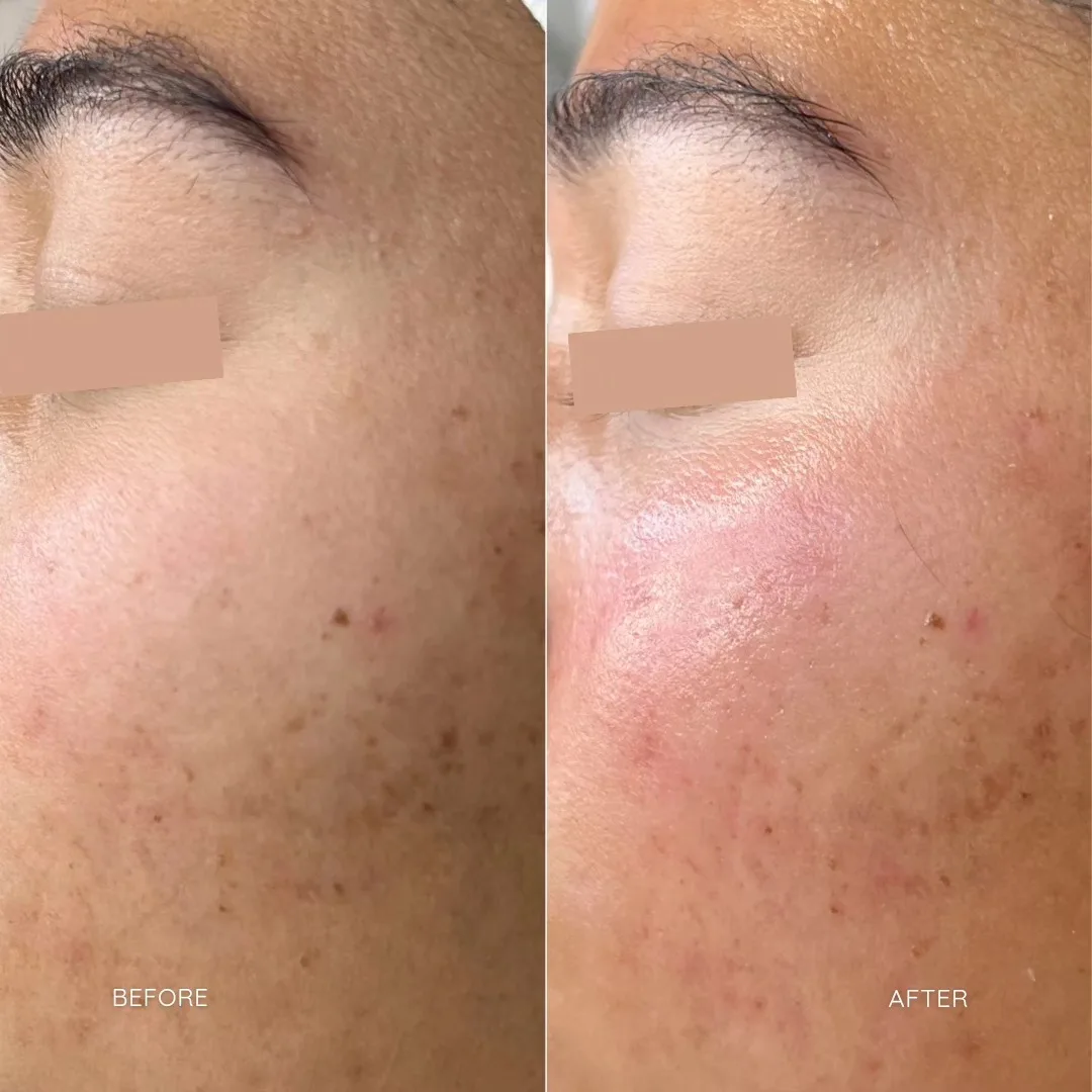 sfe b&a2