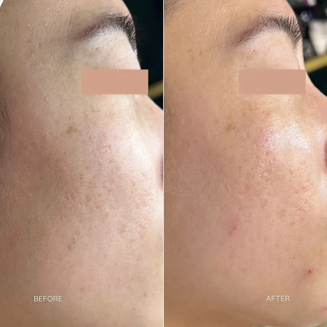 sfe b&a3