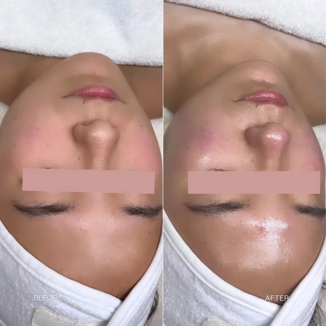 sfe b&a4
