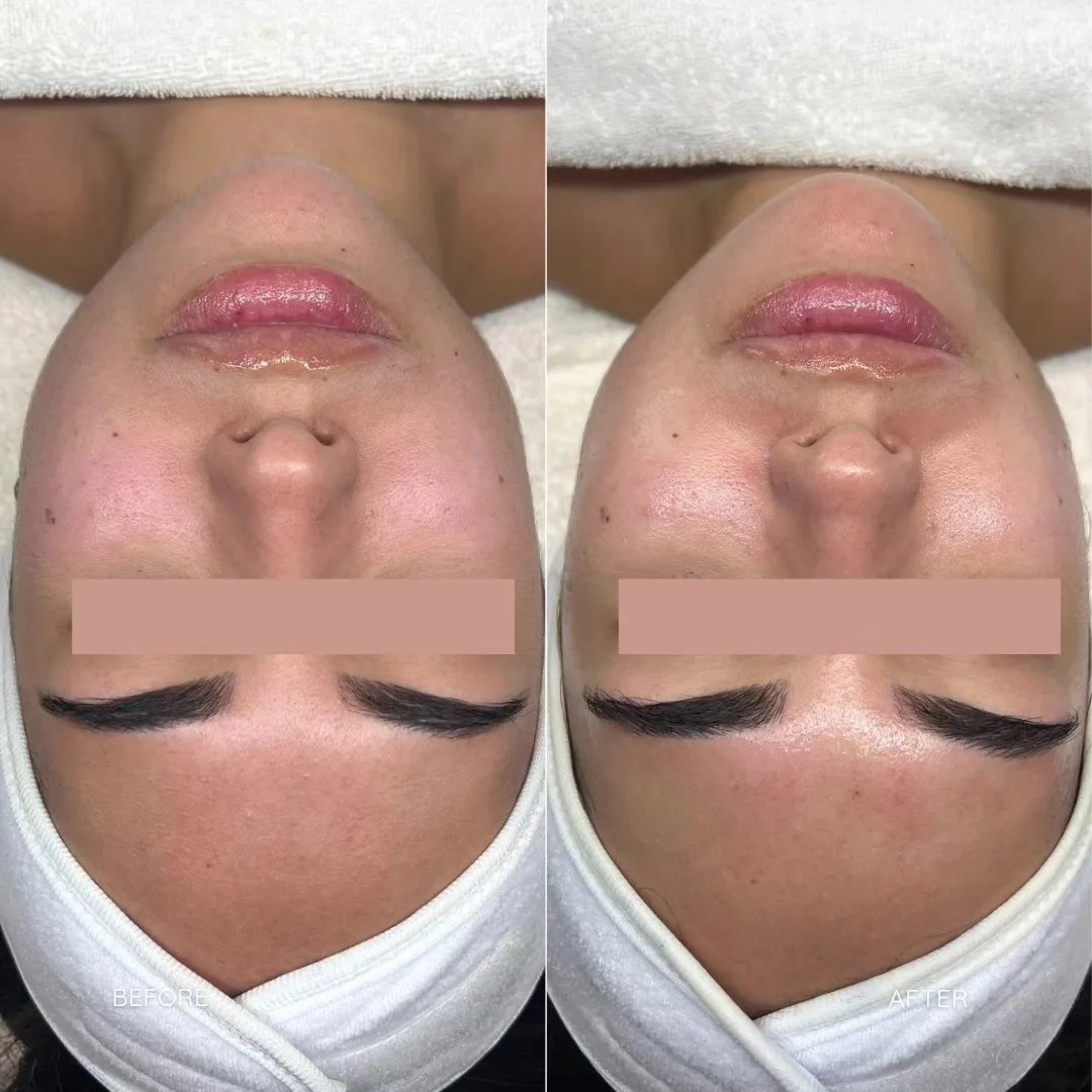 sfe b&a5